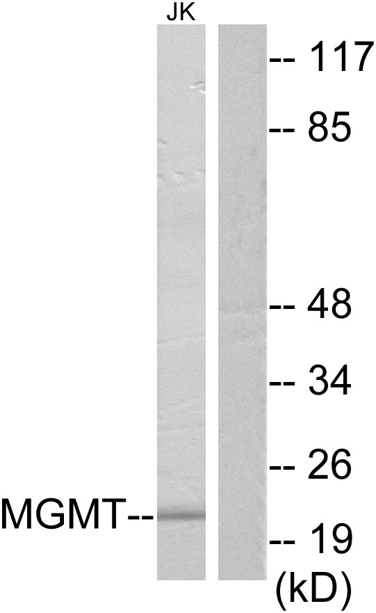 MGMT Antibody - Western blot analysis of lysates from Jurkat cells, using MGMT Antibody. The lane on the right is blocked with the synthesized peptide.