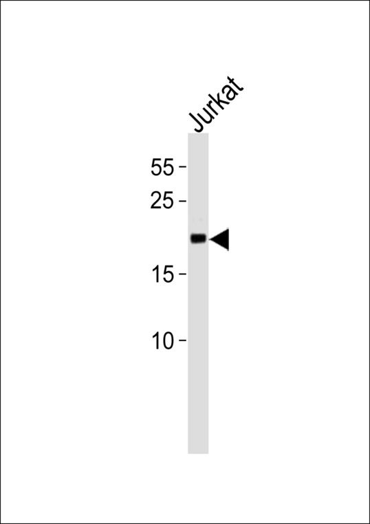 MGMT Antibody - MGMT Antibody western blot of Jurkat cell line lysates (35 ug/lane). The MGMT antibody detected the MGMT protein (arrow).