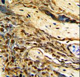 MGMT Antibody - Formalin-fixed and paraffin-embedded human placenta with MGMT Antibody , which was peroxidase-conjugated to the secondary antibody, followed by DAB staining. This data demonstrates the use of this antibody for immunohistochemistry; clinical relevance has not been evaluated.