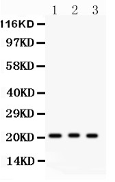 MGMT Antibody - MGMT antibody Western blot. All lanes: Anti MGMT at 0.5 ug/ml. Lane 1: HELA Whole Cell Lysate at 40 ug. Lane 2: Human Placenta Tissue Lysate at 50 ug. Lane 3: JURKAT Whole Cell Lysate at 40 ug. Predicted band size: 21 kD. Observed band size: 21 kD.