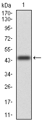 MGMT Antibody - Western blot analysis using MGMT mAb against human MGMT (AA: 32-210) recombinant protein. (Expected MW is 45.2 kDa)