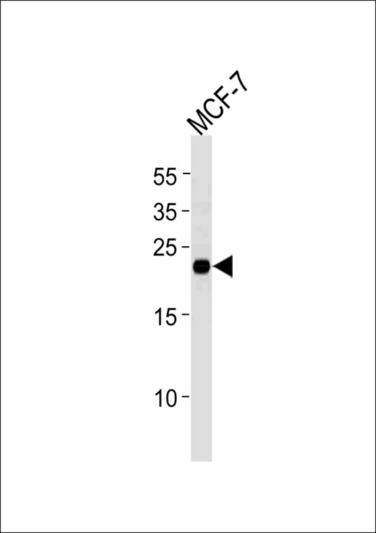 MGMT Antibody - MGMT Antibody western blot of MCF-7 cell line lysates (35 ug/lane). The MGMT antibody detected the MGMT protein (arrow).