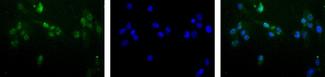 MGMT Antibody - Immunocytochemistry/Immunofluorescence: MGMT Antibody (MT 23.2) - Detection of MGMT (Green) in Hela cells at a 1:50 dilution.  Nuclei (Blue) are counterstained using Hoechst 33258.