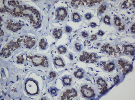 MGMT Antibody - IHC of paraffin-embedded Human breast tissue using anti-MGMT mouse monoclonal antibody.