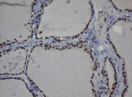MGMT Antibody - IHC of paraffin-embedded Human thyroid tissue using anti-MGMT mouse monoclonal antibody.