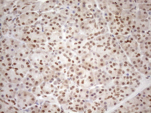 MGMT Antibody - Immunohistochemical staining of paraffin-embedded Human pancreas tissue within the normal limits using anti-MGMT mouse monoclonal antibody. (Heat-induced epitope retrieval by 1mM EDTA in 10mM Tris buffer. (pH8.5) at 120°C for 3 min. (1:150)