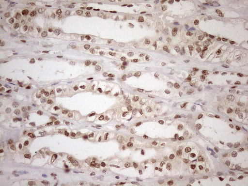 MGMT Antibody - Immunohistochemical staining of paraffin-embedded Human Kidney tissue within the normal limits using anti-MGMT mouse monoclonal antibody. (Heat-induced epitope retrieval by 1mM EDTA in 10mM Tris buffer. (pH8.5) at 120°C for 3 min. (1:150)