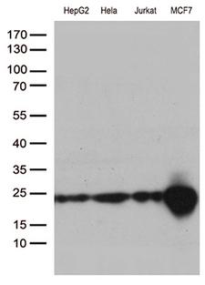 MGMT Antibody - Western blot analysis of extracts. (35ug) from 4 different cell lines by using anti-MGMT monoclonal antibody. (1:500)