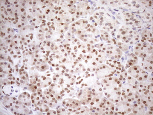 MGMT Antibody - Immunohistochemical staining of paraffin-embedded Human pancreas tissue within the normal limits using anti-MGMT mouse monoclonal antibody. (Heat-induced epitope retrieval by 1mM EDTA in 10mM Tris buffer. (pH8.5) at 120°C for 3 min. (1:150)