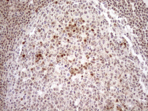 MGMT Antibody - Immunohistochemical staining of paraffin-embedded Human tonsil within the normal limits using anti-MGMT mouse monoclonal antibody. (Heat-induced epitope retrieval by 1mM EDTA in 10mM Tris buffer. (pH8.5) at 120°C for 3 min. (1:150)