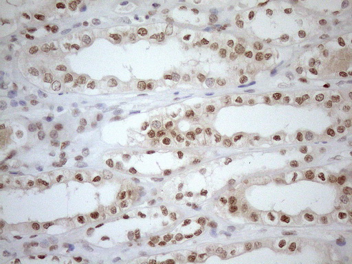 MGMT Antibody - Immunohistochemical staining of paraffin-embedded Human Kidney tissue within the normal limits using anti-MGMT mouse monoclonal antibody. (Heat-induced epitope retrieval by 1mM EDTA in 10mM Tris buffer. (pH8.5) at 120°C for 3 min. (1:150)