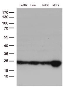 MGMT Antibody - Western blot analysis of extracts. (35ug) from 4 different cell lines by using anti-MGMT monoclonal antibody. (1:500)