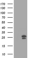 MGMT Antibody - HEK293T cells were transfected with the pCMV6-ENTRY control (Left lane) or pCMV6-ENTRY MGMT (Right lane) cDNA for 48 hrs and lysed. Equivalent amounts of cell lysates (5 ug per lane) were separated by SDS-PAGE and immunoblotted with anti-MGMT.