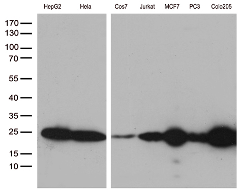 MGMT Antibody - Western blot analysis of extracts. (35ug) from 7 different cell lines by using anti-MGMT monoclonal antibody. (1:500)