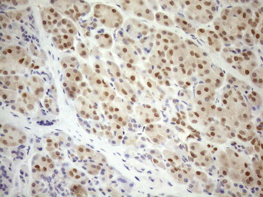 MGMT Antibody - Immunohistochemical staining of paraffin-embedded Human pancreas tissue within the normal limits using anti-MGMT mouse monoclonal antibody. (Heat-induced epitope retrieval by 1mM EDTA in 10mM Tris buffer. (pH8.5) at 120°C for 3 min. (1:150)