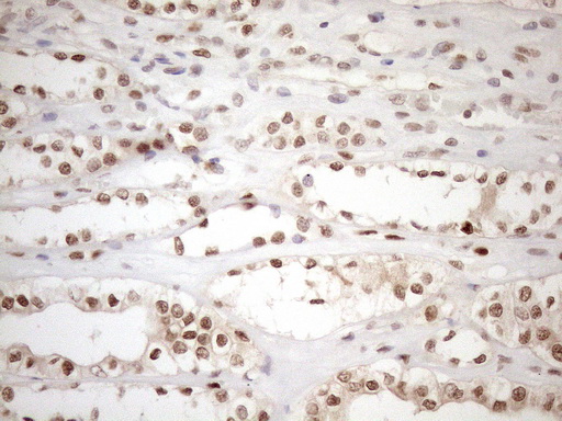 MGMT Antibody - Immunohistochemical staining of paraffin-embedded Human Kidney tissue within the normal limits using anti-MGMT mouse monoclonal antibody. (Heat-induced epitope retrieval by 1mM EDTA in 10mM Tris buffer. (pH8.5) at 120°C for 3 min. (1:150)