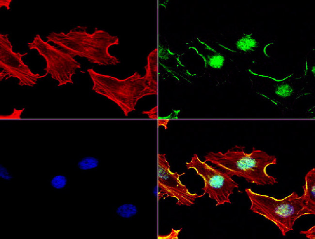 MGMT Antibody - Immunofluorescent staining of HeLa cells using MGMT mouse monoclonal antibody  green). Actin filaments were labeled with TRITC-phalloidin. (red), and nuclear with DAPI. (blue). The three-color overlay image is located at the bottom-right corner.