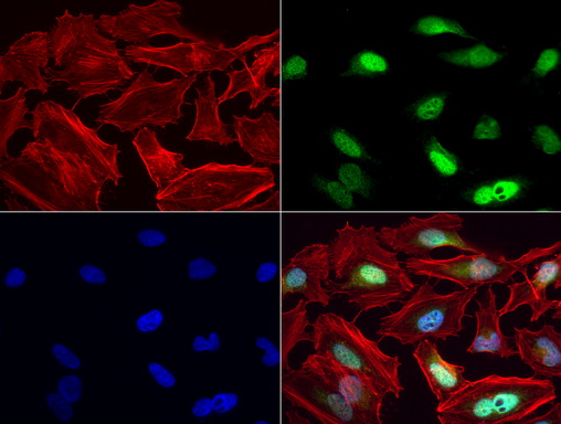 MGMT Antibody - Immunofluorescent staining of HeLa cells using anti-MGMT mouse monoclonal antibody  green, 1:50). Actin filaments were labeled with Alexa Fluor® 594 Phalloidin. (red), and nuclear with DAPI. (blue).