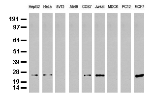 MGMT Antibody - Western blot analysis of extracts. (35ug) from 9 different cell lines by using anti-MGMT monoclonal antibody. (Clone UMAB52).