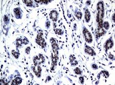 MGMT Antibody - Immunohistochemical staining of paraffin-embedded Human breast tissue using anti-MGMT mouse monoclonal antibody.  heat-induced epitope retrieval by 10mM citric buffer, pH6.0, 120C for 3min)