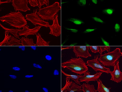 MGMT Antibody - Immunofluorescent staining of HeLa cells using anti-MGMT mouse monoclonal antibody  green, 1:50). Actin filaments were labeled with Alexa Fluor® 594 Phalloidin. (red), and nuclear with DAPI. (blue).