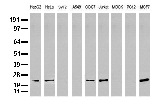 MGMT Antibody - Western blot analysis of extracts. (35ug) from 9 different cell lines by using anti-MGMT monoclonal antibody. (Clone UMAB56).