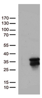 MGMT Antibody - HEK293T cells were transfected with the pCMV6-ENTRY control. (Left lane) or pCMV6-ENTRY MGMT. (Right lane) cDNA for 48 hrs and lysed. Equivalent amounts of cell lysates. (5 ug per lane) were separated by SDS-PAGE and immunoblotted with anti-MGMT. (1:500)