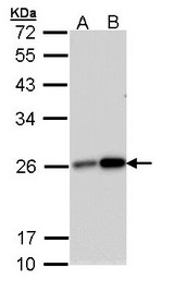 MGMT Antibody - Sample (30 ug of whole cell lysate). A: 293T. B: A431. 12% SDS PAGE. MGMT antibody diluted at 1:1000. 