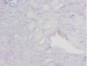 MGMT Antibody - Immunohistochemistry of paraffin-embedded human kidney tissue using MGMT Antibody at dilution of 1:20