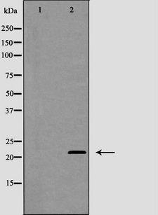 MGMT Antibody - Western blot analysis of MGMT expression in Jurkat cells. The lane on the left is treated with the antigen-specific peptide.