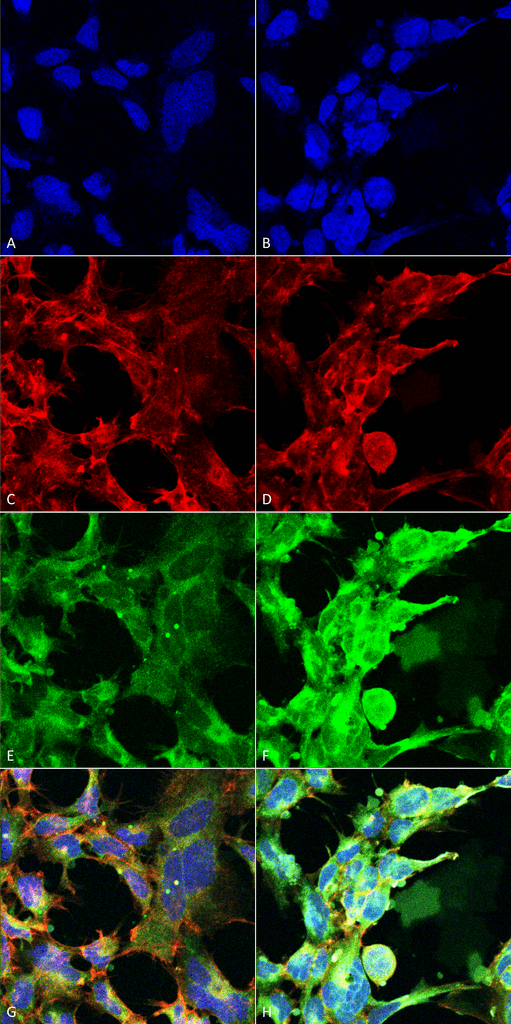 MGO / Methylglyoxal Antibody - Immunocytochemistry/Immunofluorescence analysis using Mouse Anti-Methylglyoxal Monoclonal Antibody, Clone 9F11. Tissue: Embryonic kidney epithelial cell line (HEK293). Species: Human. Fixation: 5% Formaldehyde for 5 min. Primary Antibody: Mouse Anti-Methylglyoxal Monoclonal Antibody  at 1:50 for 30-60 min at RT. Secondary Antibody: Goat Anti-Mouse Alexa Fluor 488 at 1:1500 for 30-60 min at RT. Counterstain: Phalloidin Alexa Fluor 633 F-Actin stain; DAPI (blue) nuclear stain at 1:250, 1:50000 for 30-60 min at RT. Magnification: 20X (2X Zoom). (A,C,E,G) - Untreated. (B,D,F,H) - Cells cultured overnight with 50 µM H2O2. (A,B) DAPI (blue) nuclear stain. (C,D) Phalloidin Alexa Fluor 633 F-Actin stain. (E,F) Methylglyoxal Antibody. (G,H) Composite. Courtesy of: Dr. Robert Burke, University of Victoria.
