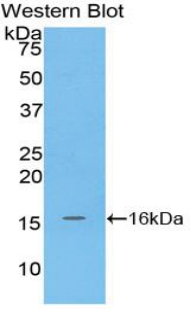 MGP / Matrix Gla-Protein Antibody - Western blot of recombinant MGP / Matrix Gla-Protein.  This image was taken for the unconjugated form of this product. Other forms have not been tested.