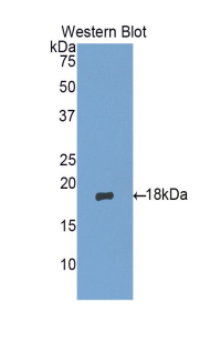 MGP / Matrix Gla-Protein Antibody - Western blot of recombinant MGP / Matrix Gla-Protein.  This image was taken for the unconjugated form of this product. Other forms have not been tested.