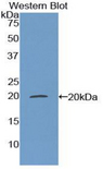 MGP / Matrix Gla-Protein Antibody - Western blot of recombinant MGP / Matrix Gla-Protein.  This image was taken for the unconjugated form of this product. Other forms have not been tested.