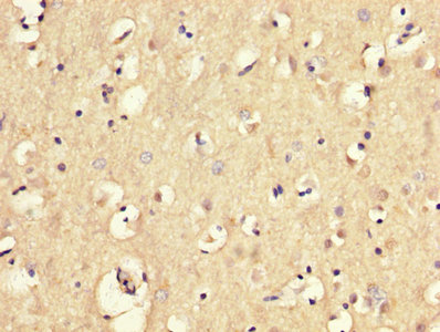 MGP / Matrix Gla-Protein Antibody - IHC image of MGP Antibody diluted at 1:300 and staining in paraffin-embedded human brain tissue performed on a Leica BondTM system. After dewaxing and hydration, antigen retrieval was mediated by high pressure in a citrate buffer (pH 6.0). Section was blocked with 10% normal goat serum 30min at RT. Then primary antibody (1% BSA) was incubated at 4°C overnight. The primary is detected by a biotinylated secondary antibody and visualized using an HRP conjugated SP system.