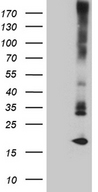 MGP / Matrix Gla-Protein Antibody - HEK293T cells were transfected with the pCMV6-ENTRY control. (Left lane) or pCMV6-ENTRY MGP. (Right lane) cDNA for 48 hrs and lysed