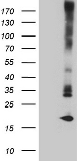 MGP / Matrix Gla-Protein Antibody - HEK293T cells were transfected with the pCMV6-ENTRY control. (Left lane) or pCMV6-ENTRY MGP. (Right lane) cDNA for 48 hrs and lysed