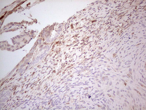 MGP / Matrix Gla-Protein Antibody - Immunohistochemical staining of paraffin-embedded Human endometrium tissue within the normal limits using anti-MGP mouse monoclonal antibody. (Heat-induced epitope retrieval by Tris-EDTA, pH8.0) Dilution: 1:150