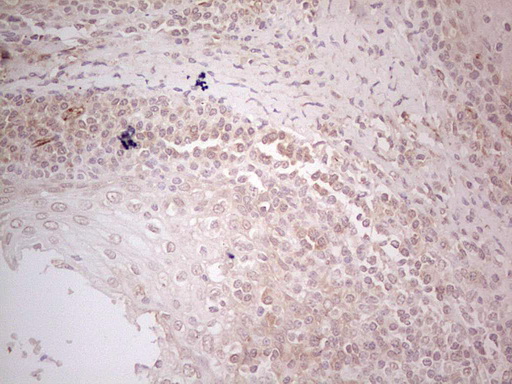 MGP / Matrix Gla-Protein Antibody - Immunohistochemical staining of paraffin-embedded Human tonsil within the normal limits using anti-MGP mouse monoclonal antibody. (Heat-induced epitope retrieval by Tris-EDTA, pH8.0) Dilution: 1:150
