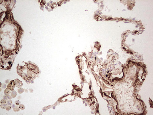 MGP / Matrix Gla-Protein Antibody - Immunohistochemical staining of paraffin-embedded Human lung tissue within the normal limits using anti-MGP mouse monoclonal antibody. (Heat-induced epitope retrieval by Tris-EDTA, pH8.0) Dilution: 1:150