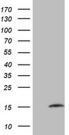 MGP / Matrix Gla-Protein Antibody - HEK293T cells were transfected with the pCMV6-ENTRY control (Left lane) or pCMV6-ENTRY MGP (Right lane) cDNA for 48 hrs and lysed. Equivalent amounts of cell lysates (5 ug per lane) were separated by SDS-PAGE and immunoblotted with anti-MGP.
