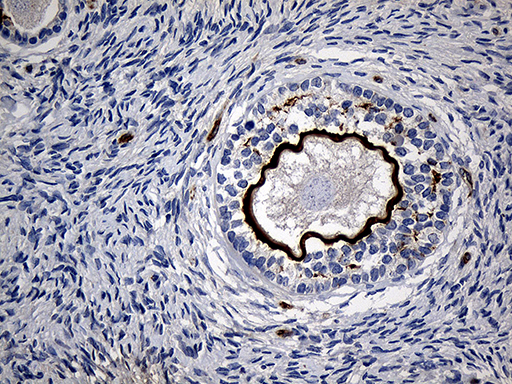 MGP / Matrix Gla-Protein Antibody - Immunohistochemical staining of paraffin-embedded Human Ovary tissue within the normal limits using anti-MGP mouse monoclonal antibody. (Heat-induced epitope retrieval by 1mM EDTA in 10mM Tris buffer. (pH8.5) at 120°C for 3 min. (1:500)