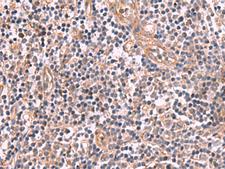 MGP / Matrix Gla-Protein Antibody - Immunohistochemistry of paraffin-embedded Human tonsil tissue  using MGP Polyclonal Antibody at dilution of 1:75(×200)