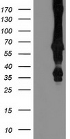 MGRN1 Antibody - HEK293T cells were transfected with the pCMV6-ENTRY control (Left lane) or pCMV6-ENTRY MGRN1 (Right lane) cDNA for 48 hrs and lysed. Equivalent amounts of cell lysates (5 ug per lane) were separated by SDS-PAGE and immunoblotted with anti-MGRN1.