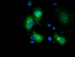 MGRN1 Antibody - Anti-MGRN1 mouse monoclonal antibody immunofluorescent staining of COS7 cells transiently transfected by pCMV6-ENTRY MGRN1.