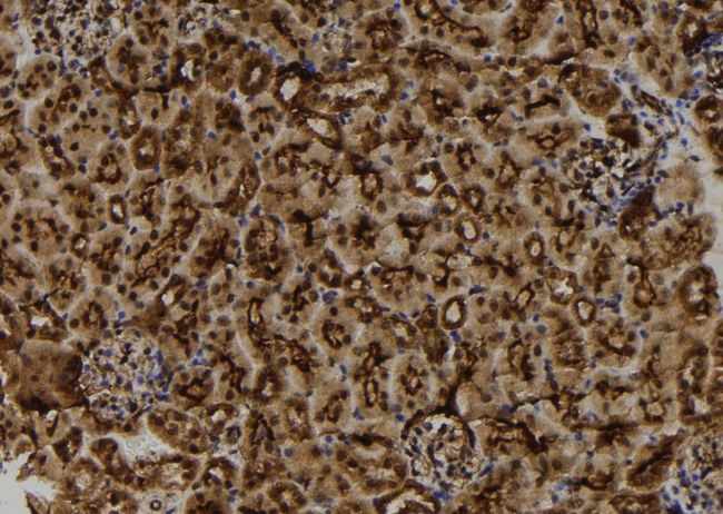 MGRN1 Antibody - 1:100 staining mouse kidney tissue by IHC-P. The sample was formaldehyde fixed and a heat mediated antigen retrieval step in citrate buffer was performed. The sample was then blocked and incubated with the antibody for 1.5 hours at 22°C. An HRP conjugated goat anti-rabbit antibody was used as the secondary.