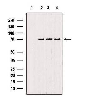 MGRN1 Antibody - Western blot analysis of extracts of various samples using RNF156 antibody. Lane 1: mouse brain treated with blocking peptide. Lane 2: mouse brain; Lane 3: 3T3; Lane 4: HeLa;