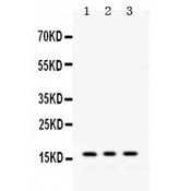 MGST1 Antibody - MGST1 antibody Western blot. All lanes: Anti MGST1 at 0.5 ug/ml. Lane 1: Rat Liver Tissue Lysate at 50 ug. Lane 2: Mouse Liver Tissue Lysate at 50 ug. Lane 3: HEPG2 Whole Cell Lysate at 40 ug. Predicted band size: 17 kD. Observed band size: 17 kD.