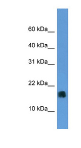 MGST1 Antibody - MGST1 antibody Western blot of Fetal Liver lysate.  This image was taken for the unconjugated form of this product. Other forms have not been tested.
