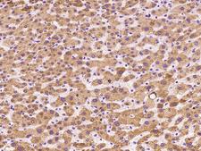 MGST1 Antibody - Immunochemical staining of human MGST1 in human liver with rabbit polyclonal antibody at 1:100 dilution, formalin-fixed paraffin embedded sections.